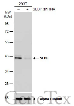 Non-transfected (–) and transfected (+) 293T whole cell extracts (30 μg) were separated by 10% SDS-PAGE, and the membrane was blotted with SLBP antibody (GTX130597) diluted at 1:2000. The HRP-conjugated anti-rabbit IgG antibody (GTX213110-01) was used to detect the primary antibody.