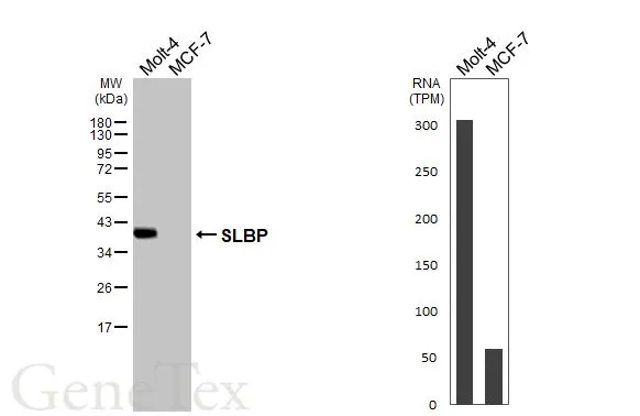 Various whole cell extracts (30 μg) were separated by 12% SDS-PAGE, and the membrane was blotted with SLBP antibody (GTX130597) diluted at 1:1000. The HRP-conjugated anti-rabbit IgG antibody (GTX213110-01) was used to detect the primary antibody. Corresponding RNA expression data are based on Human Protein Atlas program.