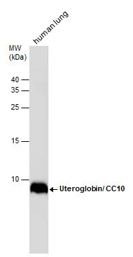 Uteroglobin/ CC10 antibody detects Uteroglobin/ CC10 protein by western blot analysis. Human tissue extracts (30 μg) was separated by 15% SDS-PAGE, and the membrane was blotted with Uteroglobin/ CC10 antibody (GTX130640) diluted at 1:5000. Uteroglobin/ CC10 antibody detects Uteroglobin/ CC10 protein by western blot analysis. Human tissue extracts (30 μg) was separated by 15% SDS-PAGE, and the membrane was blotted with Uteroglobin/ CC10 antibody (GTX130640) diluted at 1:5000.