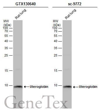 Rat tissue extract (50 μg) was separated by 15% SDS-PAGE, and the membranes were blotted with Uteroglobin antibody (GTX130640) diluted at 1:2000 and competitor's antibody (sc-9772) diluted at 1:1000. The HRP-conjugated anti-rabbit IgG antibody (GTX213110-01) was used to detect the primary antibody. Rat tissue extract (50 μg) was separated by 15% SDS-PAGE, and the membranes were blotted with Uteroglobin antibody (GTX130640) diluted at 1:2000 and competitor's antibody (sc-9772) diluted at 1:1000. The HRP-conjugated anti-rabbit IgG antibody (GTX213110-01) was used to detect the primary antibody.