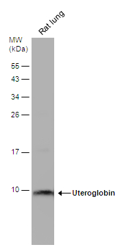 Rat tissue extract (50 μg) was separated by 15% SDS-PAGE, and the membrane was blotted with Uteroglobin antibody (GTX130640) diluted at 1:2000. The HRP-conjugated anti-rabbit IgG antibody (GTX213110-01) was used to detect the primary antibody. Rat tissue extract (50 μg) was separated by 15% SDS-PAGE, and the membrane was blotted with Uteroglobin antibody (GTX130640) diluted at 1:2000. The HRP-conjugated anti-rabbit IgG antibody (GTX213110-01) was used to detect the primary antibody.