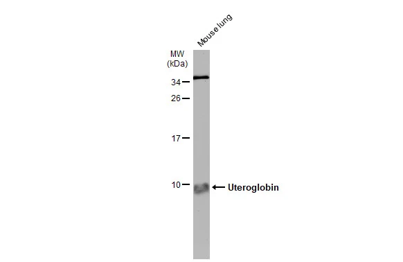 Mouse tissue extract (50 μg) was separated by 15% SDS-PAGE, and the membrane was blotted with Uteroglobin antibody (GTX130640) diluted at 1:500. The HRP-conjugated anti-rabbit IgG antibody (GTX213110-01) was used to detect the primary antibody.