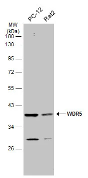 Various whole cell extracts (30 μg) were separated by 10% SDS-PAGE, and the membrane was blotted with WDR5 antibody (GTX130644) diluted at 1:1000. The HRP-conjugated anti-rabbit IgG antibody (GTX213110-01) was used to detect the primary antibody. Various whole cell extracts (30 μg) were separated by 10% SDS-PAGE, and the membrane was blotted with WDR5 antibody (GTX130644) diluted at 1:1000. The HRP-conjugated anti-rabbit IgG antibody (GTX213110-01) was used to detect the primary antibody.