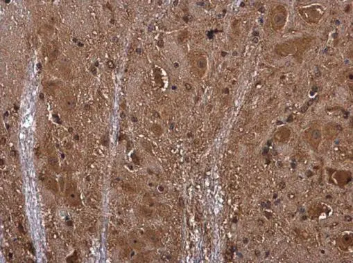 Semaphorin 3A antibody