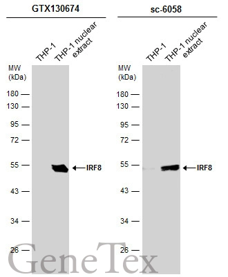 THP-1 whole cell and nuclear extracts (30 μg) were separated by 10% SDS-PAGE, and the membranes were blotted with IRF8 antibody [C3], C-term (GTX130674) diluted at 1:1000 and competitor's antibody (sc-6058) diluted at 1:100. The HRP-conjugated anti-rabbit IgG antibody (GTX213110-01) was used to detect the primary antibody.