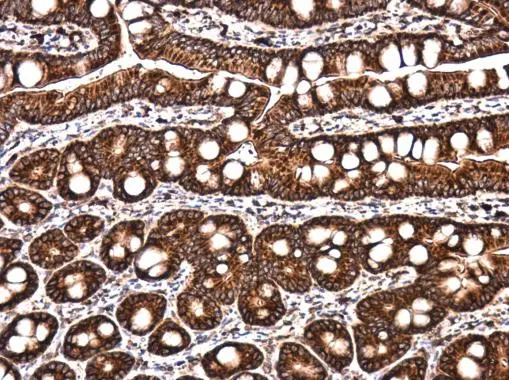 LYRIC antibody detects LYRIC protein at cytoplasm in rat intestine by immunohistochemical analysis. Sample: Paraffin-embedded rat intestine. LYRIC antibody (GTX130679) diluted at 1:500. 
 Antigen Retrieval: Citrate buffer, pH 6.0, 15 min