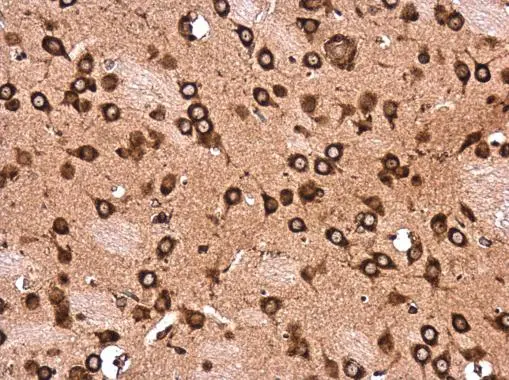 LYRIC antibody detects LYRIC protein at cytoplasm in rat brain by immunohistochemical analysis. Sample: Paraffin-embedded rat brain. LYRIC antibody (GTX130679) diluted at 1:500. 
 Antigen Retrieval: Citrate buffer, pH 6.0, 15 min