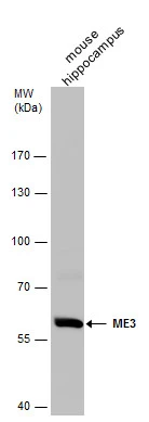 ME3 antibody detects ME3 protein by western blot analysis. Mouse tissue extracts (50 μg) was separated by 7.5 % SDS-PAGE, and the membrane was blotted with ME3 antibody (GTX130689) at a dilution of 1:500.