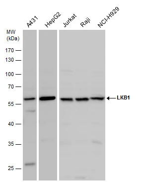 LKB1 antibody detects LKB1 protein by western blot analysis. Various whole cell extracts (30 μg) were separated by 10% SDS-PAGE, and the membrane was blotted with LKB1 antibody (GTX130697) diluted at a dilution of 1:1000.