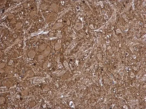 LKB1 antibody detects LKB1 protein at cytoplasm in mouse brain by immunohistochemical analysis. Sample: Paraffin-embedded mouse brain. LKB1 antibody (GTX130697) diluted at 1:500.
Antigen Retrieval: Citrate buffer, pH 6.0, 15 min