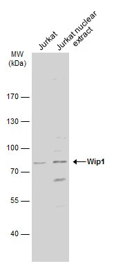 Jurkat whole cell and nuclear extracts (30 μg) were separated by 7.5% SDS-PAGE, and the membrane was blotted with Wip1 antibody (GTX130700) diluted at 1:1000. The HRP-conjugated anti-rabbit IgG antibody (GTX213110-01) was used to detect the primary antibody.