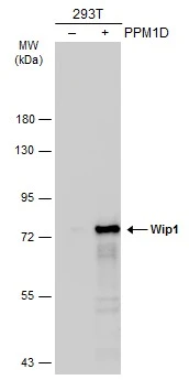 Non-transfected (–) and transfected (+) 293T whole cell extracts (30 μg) were separated by 7.5% SDS-PAGE, and the membrane was blotted with Wip1 antibody (GTX130700) diluted at 1:5000. The HRP-conjugated anti-rabbit IgG antibody (GTX213110-01) was used to detect the primary antibody.