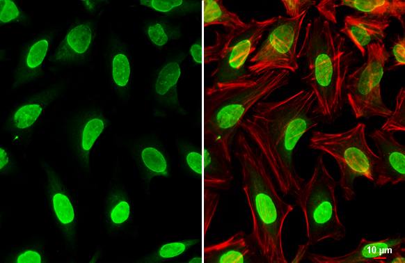 Wip1 antibody detects Wip1 protein at nucleus by immunofluorescent analysis. Sample: HeLa cells were fixed in 4% paraformaldehyde at RT for 15 min. Green: Wip1 stained by Wip1 antibody (GTX130700) diluted at 1:500. Red: phalloidin, a cytoskeleton marker, diluted at 1:100. Scale bar= 10 μm.