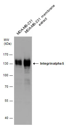 Integrin alpha 5 antibody detects Integrin alpha 5 protein by western blot analysis. Whole cell extracts and membrane extracts (30 μg) were separated by 7.5% SDS-PAGE, and the membrane was blotted with Integrin alpha 5 antibody (GTX130705) diluted at 1:5000.