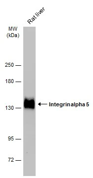 Rat tissue extract (50 μg) was separated by 5% SDS-PAGE, and the membrane was blotted with Integrin alpha 5 antibody (GTX130705) diluted at 1:5000. The HRP-conjugated anti-rabbit IgG antibody (GTX213110-01) was used to detect the primary antibody.