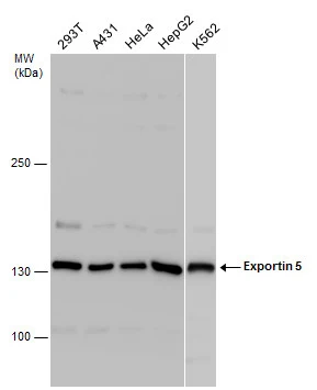 Various whole cell extracts (30 μg) were separated by 5% SDS-PAGE, and the membrane was blotted with Exportin 5 antibody (GTX130727) diluted at 1:1000.