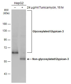 Untreated (–) and treated (+) HepG2 whole cell extracts (30 μg) were separated by 7.5% SDS-PAGE, and the membrane was blotted with Glypican-3 antibody (GTX130732) diluted at 1:1000. The HRP-conjugated anti-rabbit IgG antibody (GTX213110-01) was used to detect the primary antibody.