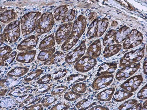 BBS4 antibody detects BBS4 protein at cytoplasm in rat colon by immunohistochemical analysis. Sample: Paraffin-embedded rat colon. BBS4 antibody (GTX130737) diluted at 1:500. 
 Antigen Retrieval: Citrate buffer, pH 6.0, 15 min