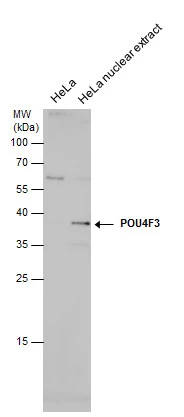 POU4F3 antibody detects POU4F3 protein by western blot analysis. HeLa whole cell extracts and nuclear extracts (30 μg) were separated by 12% SDS-PAGE, and the membrane was blotted with POU4F3 antibody (GTX130748) diluted at 1:1000.