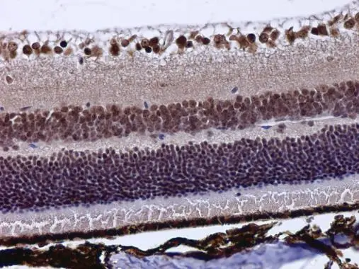 POU4F3 antibody detects POU4F3 protein at cytoplasm and nucleus in mouse eye by immunohistochemical analysis. Sample: Paraffin-embedded mouse eye. POU4F3 antibody (GTX130748) diluted at 1:500. 
 Antigen Retrieval: Citrate buffer, pH 6.0, 15 min