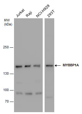 MYBBP1A antibody detects MYBBP1A protein by western blot analysis. Various whole cell extracts (30 μg) were separated by 5% SDS-PAGE, and the membrane was blotted with MYBBP1A antibody (GTX130760) diluted at a dilution of 1:2500.
