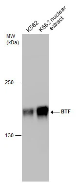 K562 whole cell and nuclear extracts (30 μg) were separated by 5% SDS-PAGE, and the membrane was blotted with BTF antibody (GTX130772) diluted at 1:1000. K562 whole cell and nuclear extracts (30 μg) were separated by 5% SDS-PAGE, and the membrane was blotted with BTF antibody (GTX130772) diluted at 1:1000.