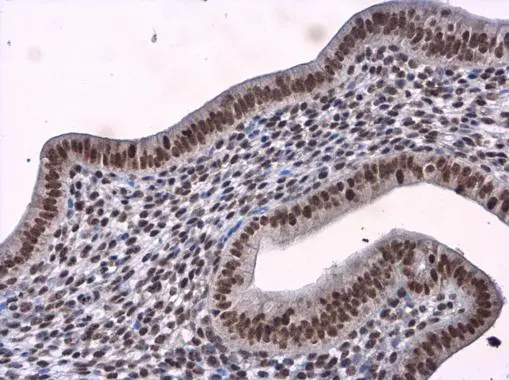 BTF antibody detects BTF protein at nucleus in mouse cervix by immunohistochemical analysis. Sample: Paraffin-embedded mouse cervix. BTF antibody (GTX130772) diluted at 1:500.
Antigen Retrieval: Citrate buffer, pH 6.0, 15 min BTF antibody detects BTF protein at nucleus in mouse cervix by immunohistochemical analysis. Sample: Paraffin-embedded mouse cervix. BTF antibody (GTX130772) diluted at 1:500.
Antigen Retrieval: Citrate buffer, pH 6.0, 15 min