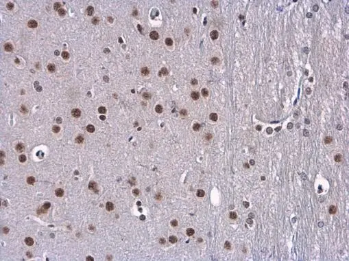 BTF antibody detects BTF protein at nucleus in rat brain by immunohistochemical analysis. Sample: Paraffin-embedded rat brain. BTF antibody (GTX130772) diluted at 1:500. 
 Antigen Retrieval: Citrate buffer, pH 6.0, 15 min
