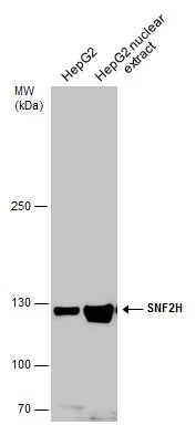 HepG2 whole cell and nuclear extracts (30 μg) were separated by 5% SDS-PAGE, and the membrane was blotted with SNF2H antibody (GTX130794) diluted at 1:10000.