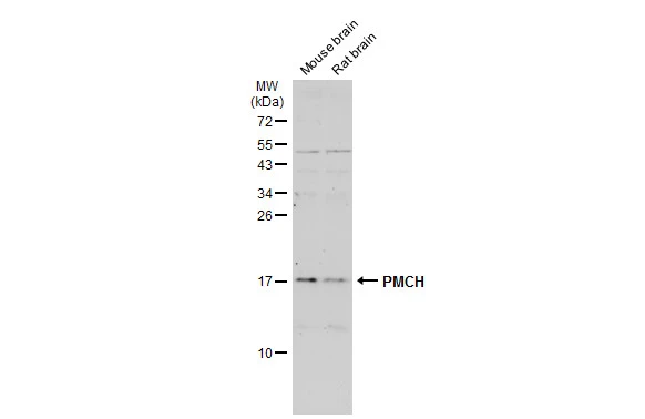 Various tissue extracts (50 μg) were separated by 15% SDS-PAGE, and the membrane was blotted with PMCH antibody (GTX130799) diluted at 1:500. The HRP-conjugated anti-rabbit IgG antibody (GTX213110-01) was used to detect the primary antibody, and the signal was developed with Trident ECL plus-Enhanced.