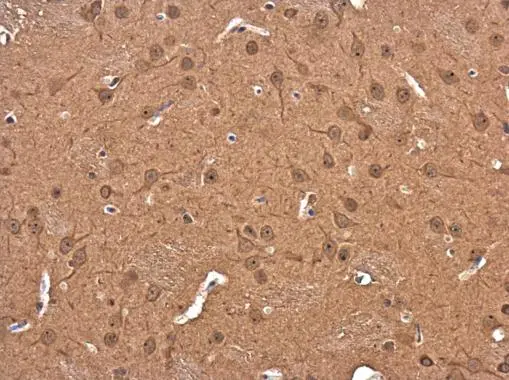 DIAPH3 antibody detects DIAPH3 protein at cytoplasm and nucleus in rat brain by immunohistochemical analysis. Sample: Paraffin-embedded rat brain. DIAPH3 antibody (GTX130803) diluted at 1:400.
Antigen Retrieval: Citrate buffer, pH 6.0, 15 min DIAPH3 antibody detects DIAPH3 protein at cytoplasm and nucleus in rat brain by immunohistochemical analysis. Sample: Paraffin-embedded rat brain. DIAPH3 antibody (GTX130803) diluted at 1:400.
Antigen Retrieval: Citrate buffer, pH 6.0, 15 min