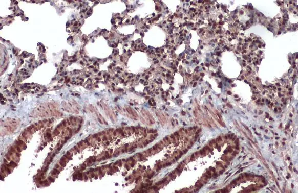 CrkRS antibody detects CrkRS protein at nucleus by immunohistochemical analysis. Sample: Paraffin-embedded mouse lung. CrkRS stained by CrkRS antibody (GTX130809) diluted at 1:500. Antigen Retrieval: Citrate buffer, pH 6.0, 15 min