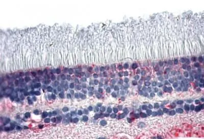IHC-P analysis of human retina tissue using GTX13081 NR2E3 antibody. Antigen retrieval : Heat-induced antigen retrieval IHC-P analysis of human retina tissue using GTX13081 NR2E3 antibody. Antigen retrieval : Heat-induced antigen retrieval