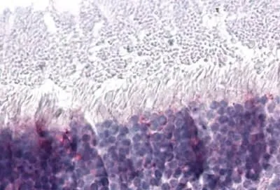 Immunohistochemical staining of human tissue sections using NR2E3 antibody (GTX13082)