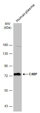 Human plasma (30 μg) was separated by 7.5% SDS-PAGE, and the membrane was blotted with C4BP antibody (GTX130821) diluted at 1:5000. The HRP-conjugated anti-rabbit IgG antibody (GTX213110-01) was used to detect the primary antibody.