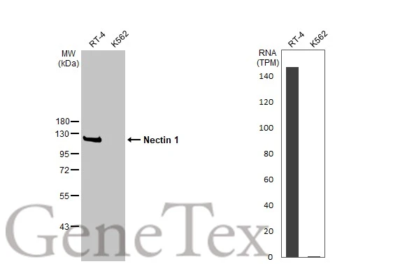 Various whole cell extracts (30 μg) were separated by 10% SDS-PAGE, and the membrane was blotted with Nectin 1 antibody (GTX130824) diluted at 1:500. The HRP-conjugated anti-rabbit IgG antibody (GTX213110-01) was used to detect the primary antibody. Corresponding RNA expression data for the same cell lines are based on Human Protein Atlas program. Various whole cell extracts (30 μg) were separated by 10% SDS-PAGE, and the membrane was blotted with Nectin 1 antibody (GTX130824) diluted at 1:500. The HRP-conjugated anti-rabbit IgG antibody (GTX213110-01) was used to detect the primary antibody. Corresponding RNA expression data for the same cell lines are based on Human Protein Atlas program.