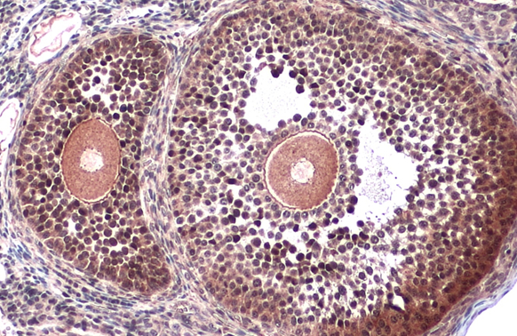 VRK2 antibody detects VRK2 protein at cell membrane and cytoplasm by immunohistochemical analysis. Sample: Paraffin-embedded mouse ovary. VRK2 stained by VRK2 antibody (GTX130826) diluted at 1:500. Antigen Retrieval: Citrate buffer, pH 6.0, 15 min