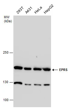 EPRS antibody detects EPRS protein by western blot analysis. Various whole cell extracts (30 ug) were separated by 5% SDS-PAGE,and the membrane was blotted with EPRS antibody (GTX130848) diluted at a dilution of 1:1000.
