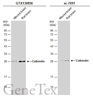Various tissue extracts (50 μg) were separated by 12% SDS-PAGE, and the membranes were blotted with Calbindin antibody (GTX130856) diluted at 1:1000 and competitor's antibody (sc-7691) diluted at 1:1000. The HRP-conjugated anti-rabbit IgG antibody (GTX213110-01) was used to detect the primary antibody.