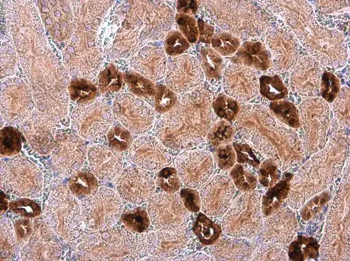 Calbindin antibody detects Calbindin protein at cytoplasm in mouse kidney by immunohistochemical analysis. Sample: Paraffin-embedded mouse kidney. Calbindin antibody (GTX130856) diluted at 1:1000. 
 Antigen Retrieval: Citrate buffer, pH 6.0, 15 min