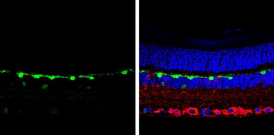 Calbindin antibody detects Calbindin protein by immunohistochemical analysis. Samples: Paraffin-embedded mouse retina. Green: Calbindin protein stained by Calbindin antibody (GTX130856) diluted at 1:500. Red: beta Tubulin 3/ Tuj1, a marker, stained by beta Tubulin 3/ Tuj1 antibody [GT886] (GTX631830) diluted at 1:500. Blue: Fluoroshield with DAPI (GTX30920). 
 Antigen Retrieval: Citrate buffer, pH 6.0, 15 min