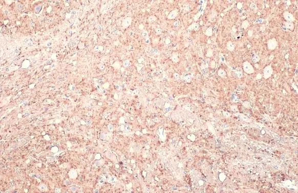 Calbindin antibody detects Calbindin protein at cytoplasm by immunohistochemical analysis. Sample: Paraffin-embedded mouse cerebellum. Calbindin stained by Calbindin antibody (GTX130856) diluted at 1:1000. Antigen Retrieval: Citrate buffer, pH 6.0, 15 min