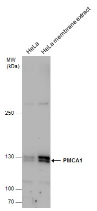 PMCA1 antibody detects PMCA1 protein by western blot analysis. HeLa whole cell extracts and membrane extracts(the extracts were unboiled )(30 μg) were separated by 5% SDS-PAGE, and the membrane was blotted with PMCA1 antibody (GTX130858) at a dilution of 1:1000.