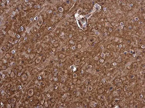 PMCA1 antibody detects PMCA1 protein at cell membrane and cytoplasm in mouse brain by immunohistochemical analysis. Sample: Paraffin-embedded mouse brain. PMCA1 antibody (GTX130858) diluted at 1:500. 
 Antigen Retrieval: Citrate buffer, pH 6.0, 15 min