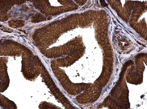 PMCA1 antibody detects PMCA1 protein at cell membrane and cytoplasm in rat prostate by immunohistochemical analysis. Sample: Paraffin-embedded rat prostate. PMCA1 antibody (GTX130858) diluted at 1:500. 
 Antigen Retrieval: Citrate buffer, pH 6.0, 15 min