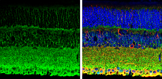 PMCA1 antibody detects PMCA1 protein expression by immunohistochemical analysis. Sample:Paraffin-Embedded adult mouse retina. Green: PMCA1 protein stained by PMCA1 antibody (GTX130858) diluted at 1:250. Red: beta Tubulin 3/ TUJ1, stained by beta Tubulin 3/ TUJ1 antibody [GT11710] (GTX631836) diluted at 1:500. Blue: Fluoroshield with DAPI (GTX30920).