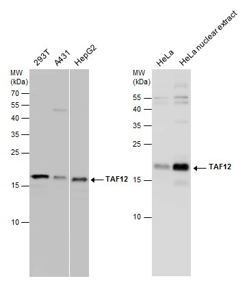TAF12 antibody detects TAF12 protein by western blot analysis. Various whole cell extracts (30 μg) were separated by 15% SDS-PAGE, and the membrane was blotted with TAF12 antibody (GTX130863) diluted at 1:1000.