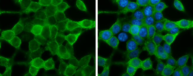 IRS4 antibody detects IRS4 protein at cell membrane by immunofluorescent analysis. Sample: 293T cells were fixed in 4% paraformaldehyde at RT for 15 min. Green: IRS4 stained by IRS4 antibody (GTX130865) diluted at 1:500. Blue: Hoechst 33342 staining.