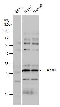 GAMT antibody detects GAMT protein by western blot analysis. Various whole cell extracts (30 μg) were separated by 12% SDS-PAGE, and the membrane was blotted with GAMT antibody (GTX130872) diluted at a dilution of 1:1000.