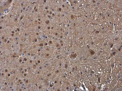 PSMB1 antibody detects PSMB1 protein at cytoplasm and nucleus in mouse brain by immunohistochemical analysis. Sample: Paraffin-embedded mouse brain. PSMB1 antibody (GTX130875) diluted at 1:500.
Antigen Retrieval: Citrate buffer, pH 6.0, 15 min PSMB1 antibody detects PSMB1 protein at cytoplasm and nucleus in mouse brain by immunohistochemical analysis. Sample: Paraffin-embedded mouse brain. PSMB1 antibody (GTX130875) diluted at 1:500.
Antigen Retrieval: Citrate buffer, pH 6.0, 15 min